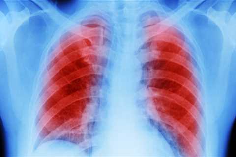 Is mesothelioma only in the lungs?