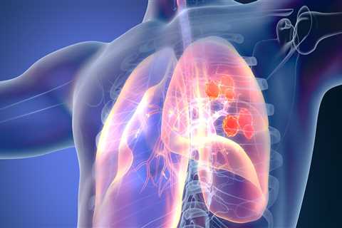 Which organ does pleural mesothelioma affect?