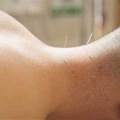 Physical Therapy Acupuncture Training