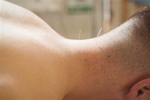 Physical Therapy Acupuncture Training