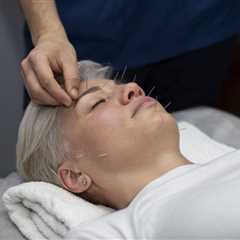 Facelift Acupuncture Training