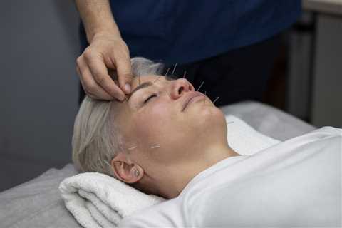 Facelift Acupuncture Training